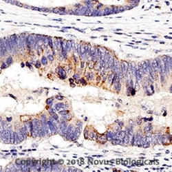 Nucleolin Antibody, Novus Biologicals:Antibodies:Primary Antibodies