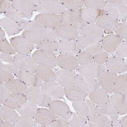 Nucleoporin NUP85 Antibody, Novus Biologicals:Antibodies:Primary Antibodies