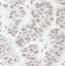 Nucleostemin Antibody, Novus Biologicals 0.1mL; Unlabeled:Antibodies, Polyclonal