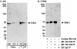 Nucleostemin Antibody, Novus Biologicals 0.1mL; Unlabeled:Antibodies, Polyclonal