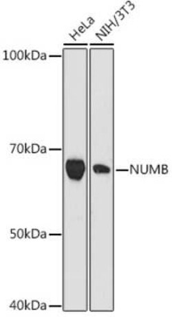Numb Rabbit anti-Human, Mouse, Clone: 9X1Y0, Novus Biologicals 100 &mu;g;