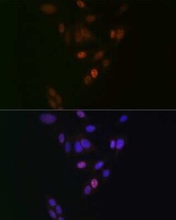 Nup153 Rabbit anti-Human, Mouse, Rat, Clone: 3I5V3, Novus Biologicals:Antibodies:Primary