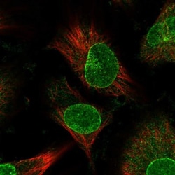 Nup153 Antibody, Novus Biologicals:Antibodies:Primary Antibodies