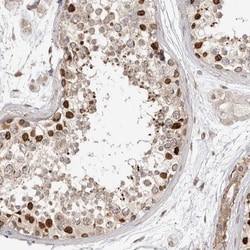 Nup153 Antibody, Novus Biologicals:Antibodies:Primary Antibodies