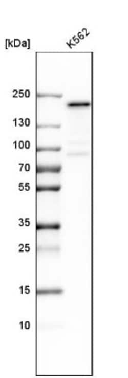 Nup153 Antibody, Novus Biologicals:Antibodies:Primary Antibodies