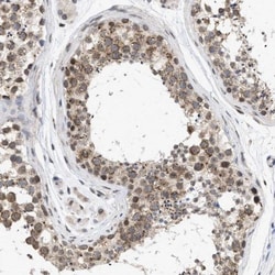 Nup53 Antibody, Novus Biologicals:Antibodies:Primary Antibodies