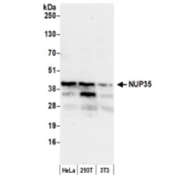 Nup53 Antibody, Novus Biologicals 0.1mL; Unlabeled:Antibodies, Polyclonal