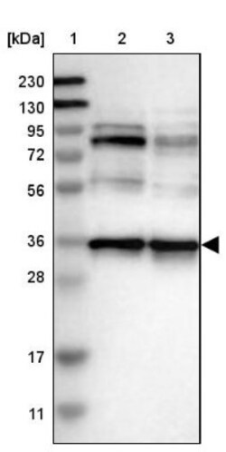 Nup53 Antibody, Novus Biologicals 25 &mu;L, Unconjugated:Antibodies, Polyclonal