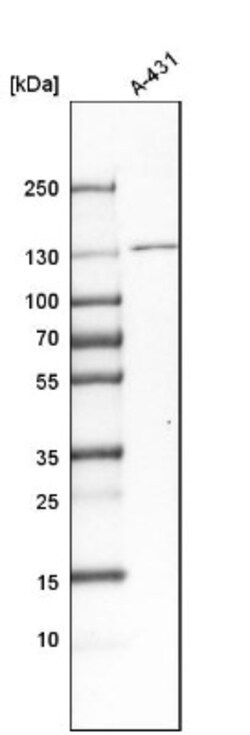 O-GlcNAcase/OGA/MGEA5 Antibody, Novus Biologicals:Antibodies:Primary Antibodies