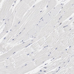 OA1 Antibody, Novus Biologicals 25 &mu;L, Unlabeled:Antibodies, Polyclonal