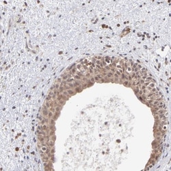 OAS1 Antibody, Novus Biologicals:Antibodies:Primary Antibodies