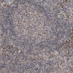 OASIS/CREB3L1 Antibody, Novus Biologicals 0.1mL; Unlabeled:Antibodies,