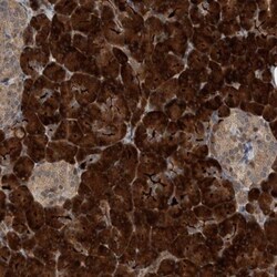 OASIS/CREB3L1 Antibody, Novus Biologicals 0.1mL; Unlabeled:Antibodies,