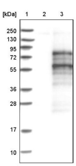 OASIS/CREB3L1 Antibody, Novus Biologicals 0.1mL; Unlabeled:Antibodies,