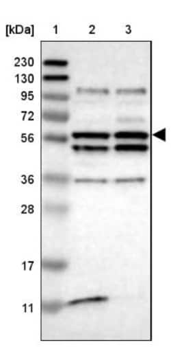 OASL Antibody, Novus Biologicals 25 &mu;L | Buy Online | Novus Biologicals | Fisher Scientific