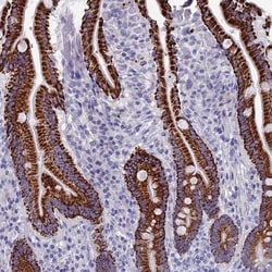 OAT Antibody, Novus Biologicals:Antibodies:Primary Antibodies