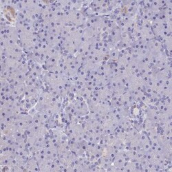 OAT Antibody, Novus Biologicals:Antibodies:Primary Antibodies
