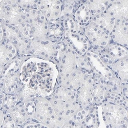 OATP1B3/SLCO1B3/OATP8 Antibody, Novus Biologicals:Antibodies:Primary Antibodies