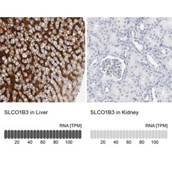 OATP1B3/SLCO1B3/OATP8 Antibody, Novus Biologicals:Antibodies:Primary Antibodies