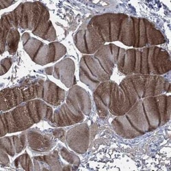 OBSCN Rabbit anti-Human, Polyclonal, Novus Biologicals:Antibodies:Primary