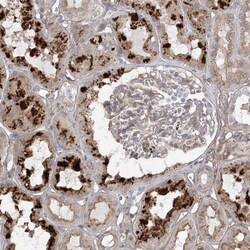 OBSL1 Antibody, Novus Biologicals 0.1mL; Unlabeled:Antibodies, Polyclonal