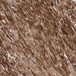 OC-STAMP Antibody, Novus Biologicals 25 &mu;L; Unlabeled:Antibodies, Polyclonal