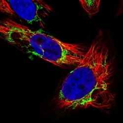 OCIAD2 Antibody, Novus Biologicals 0.1mL; Unlabeled:Antibodies, Polyclonal