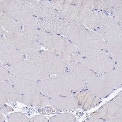 OCIAD2 Antibody, Novus Biologicals 0.1mL; Unlabeled:Antibodies, Polyclonal