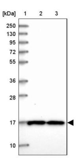 OCIAD2 Antibody, Novus Biologicals 0.1mL; Unlabeled:Antibodies, Polyclonal