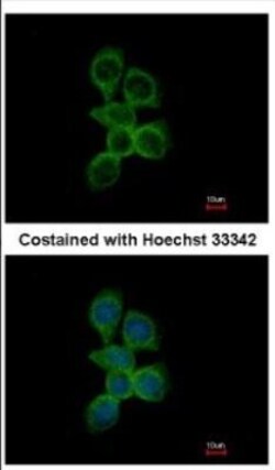 OCRL Antibody, Novus Biologicals 0.1mL; Unlabeled:Antibodies, Polyclonal