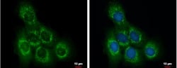 OCRL Antibody, Novus Biologicals 0.1mL; Unlabeled:Antibodies, Polyclonal