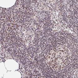 OCT1 Antibody, Novus Biologicals 0.1mL; Unlabeled:Antibodies, Polyclonal