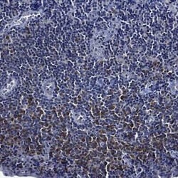 OCT2 Rabbit anti-Human, Polyclonal, Novus Biologicals 100 &mu;g; Unconjugated:Antibodies,