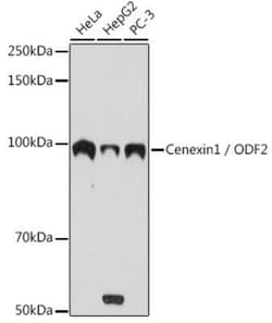 ODF2 Rabbit anti-Human, Clone: 3Z1H8, Novus Biologicals 100 &mu;g | Buy Online | Novus Biologicals | Fisher Scientific