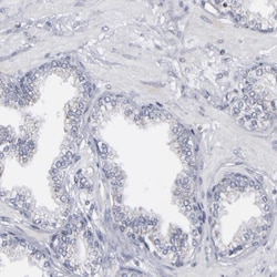 ODF2 Antibody, Novus Biologicals:Antibodies:Primary Antibodies
