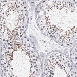 ODF2 Antibody, Novus Biologicals:Antibodies:Primary Antibodies