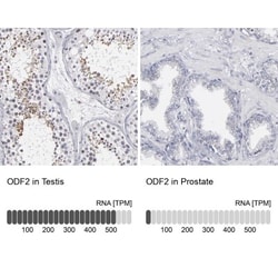 ODF2 Antibody, Novus Biologicals:Antibodies:Primary Antibodies