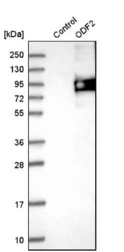 ODF2 Antibody, Novus Biologicals:Antibodies:Primary Antibodies