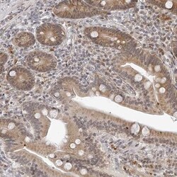 ODF2L Antibody, Novus Biologicals:Antibodies:Primary Antibodies