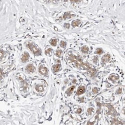 ODF2L Antibody, Novus Biologicals 25 &mu;L | Buy Online | Novus Biologicals | Fisher Scientific