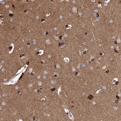 ODF3 Antibody, Novus Biologicals:Antibodies:Primary Antibodies