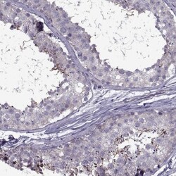 ODF3 Antibody, Novus Biologicals:Antibodies:Primary Antibodies