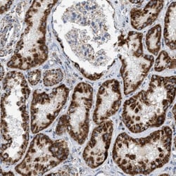 OGDH Antibody, Novus Biologicals 25 &mu;L; Unlabeled:Antibodies, Polyclonal