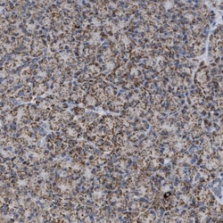 OGDH Antibody, Novus Biologicals 25 &mu;L; Unlabeled:Antibodies, Polyclonal