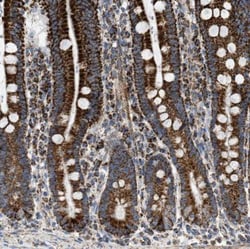 OGDH Antibody, Novus Biologicals 25 &mu;L; Unlabeled:Antibodies, Polyclonal