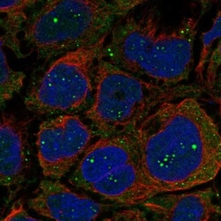 OGDHL Antibody, Novus Biologicals:Antibodies:Primary Antibodies