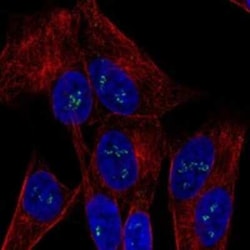 OGDHL Rabbit anti-Human, Polyclonal, Novus Biologicals 25 &mu;g; Unconjugated:Antibodies,