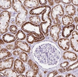 OGDHL Antibody, Novus Biologicals:Antibodies:Primary Antibodies