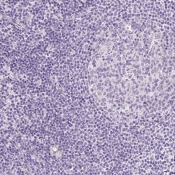 OGDHL Antibody, Novus Biologicals:Antibodies:Primary Antibodies