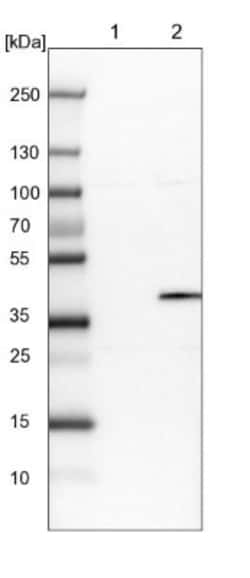 OGFOD2 Antibody, Novus Biologicals:Antibodies:Primary Antibodies